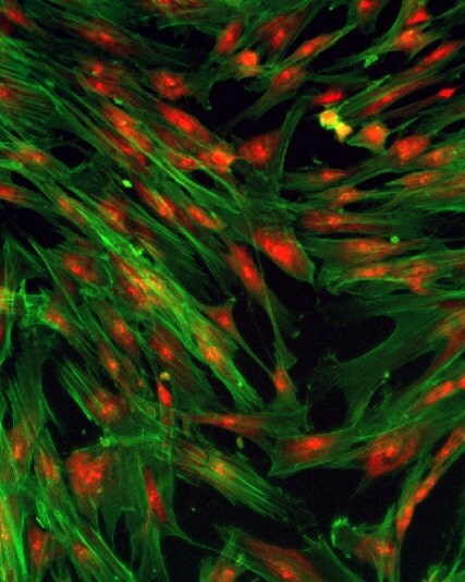 microscopic imagery.